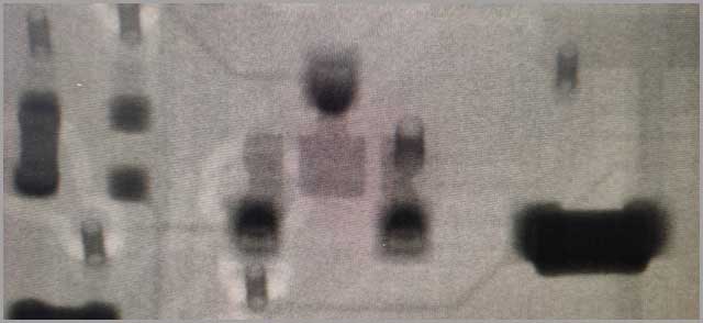 2D Transmission X-ray